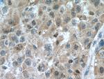 CDK2 Antibody in Immunohistochemistry (Paraffin) (IHC (P))