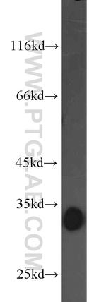 CDK2 Antibody in Western Blot (WB)