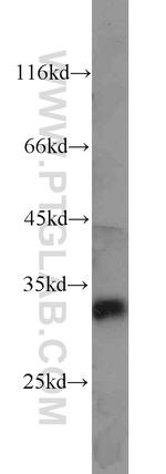 CDK2 Antibody in Western Blot (WB)