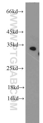 CDK2 Antibody in Western Blot (WB)