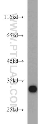 CDK2 Antibody in Western Blot (WB)