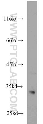 CDK2 Antibody in Western Blot (WB)