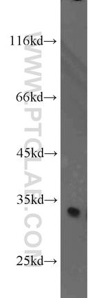 CDK2 Antibody in Western Blot (WB)