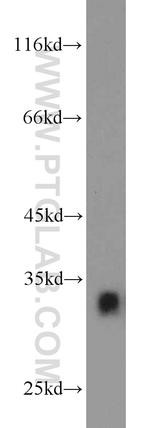 CDK2 Antibody in Western Blot (WB)