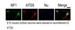 ATG5 Antibody in Immunocytochemistry (ICC/IF)