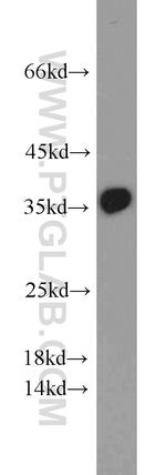 PCNA Antibody in Western Blot (WB)