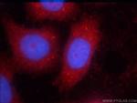 STAT3 Antibody in Immunocytochemistry (ICC/IF)