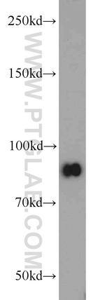 STAT3 Antibody in Western Blot (WB)