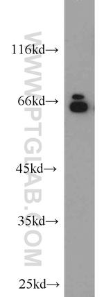 Lamin A/C Antibody in Western Blot (WB)