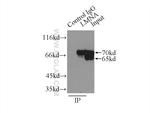 Lamin A/C Antibody in Immunoprecipitation (IP)