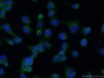 HO-1/HMOX1 Antibody in Immunocytochemistry (ICC/IF)