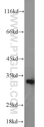 HO-1/HMOX1 Antibody in Western Blot (WB)