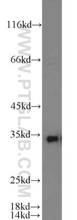 HO-1/HMOX1 Antibody in Western Blot (WB)