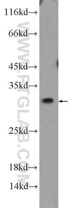 Bcl-XL Antibody in Western Blot (WB)