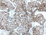 Bcl-XL Antibody in Immunohistochemistry (Paraffin) (IHC (P))