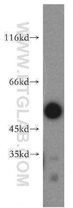 ATF4 Antibody in Western Blot (WB)