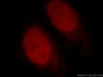 Histone H2A.X Antibody in Immunocytochemistry (ICC/IF)