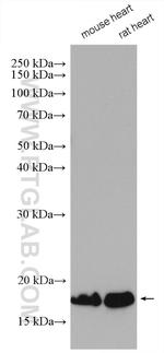 Myosin Light Chain 2 Antibody in Western Blot (WB)