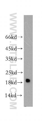 Myosin Light Chain 2 Antibody in Western Blot (WB)