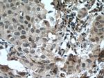 DACH1 Antibody in Immunohistochemistry (Paraffin) (IHC (P))