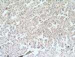 DACH1 Antibody in Immunohistochemistry (Paraffin) (IHC (P))