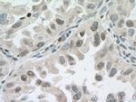 DACH1 Antibody in Immunohistochemistry (Paraffin) (IHC (P))