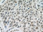 DACH1 Antibody in Immunohistochemistry (Paraffin) (IHC (P))