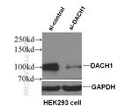 DACH1 Antibody in Western Blot (WB)