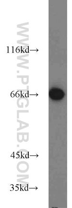 HSP70 Antibody in Western Blot (WB)