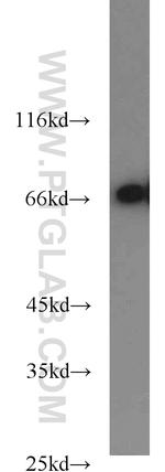 HSP70 Antibody in Western Blot (WB)