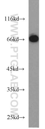 HSP70 Antibody in Western Blot (WB)