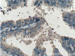 Beclin 1 Antibody in Immunohistochemistry (Paraffin) (IHC (P))