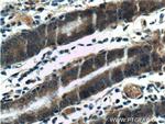 Beclin 1 Antibody in Immunohistochemistry (Paraffin) (IHC (P))