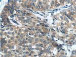 Beclin 1 Antibody in Immunohistochemistry (Paraffin) (IHC (P))