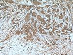 Beclin 1 Antibody in Immunohistochemistry (Paraffin) (IHC (P))