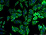 NQO1 Antibody in Immunocytochemistry (ICC/IF)