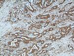 NQO1 Antibody in Immunohistochemistry (Paraffin) (IHC (P))