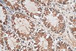 NQO1 Antibody in Immunohistochemistry (Paraffin) (IHC (P))