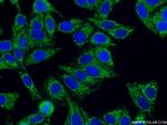 TOM20 Antibody in Immunocytochemistry (ICC/IF)