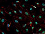 CREB1 Antibody in Immunocytochemistry (ICC/IF)