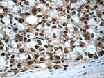 CREB1 Antibody in Immunohistochemistry (Paraffin) (IHC (P))