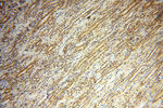 IDH1 Antibody in Immunohistochemistry (Paraffin) (IHC (P))