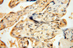 IDH1 Antibody in Immunohistochemistry (Paraffin) (IHC (P))