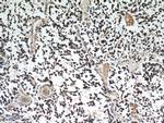 IDH1 Antibody in Immunohistochemistry (Paraffin) (IHC (P))