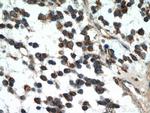 IDH1 Antibody in Immunohistochemistry (Paraffin) (IHC (P))