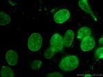 Lamin B1 Antibody in Immunocytochemistry (ICC/IF)