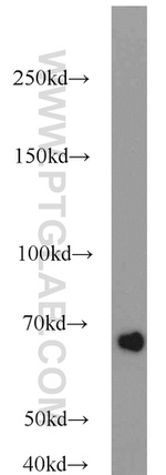 Lamin B1 Antibody in Western Blot (WB)