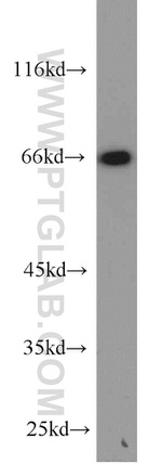 Lamin B1 Antibody in Western Blot (WB)