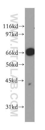 Lamin B1 Antibody in Western Blot (WB)