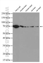 Lamin B1 Antibody in Western Blot (WB)